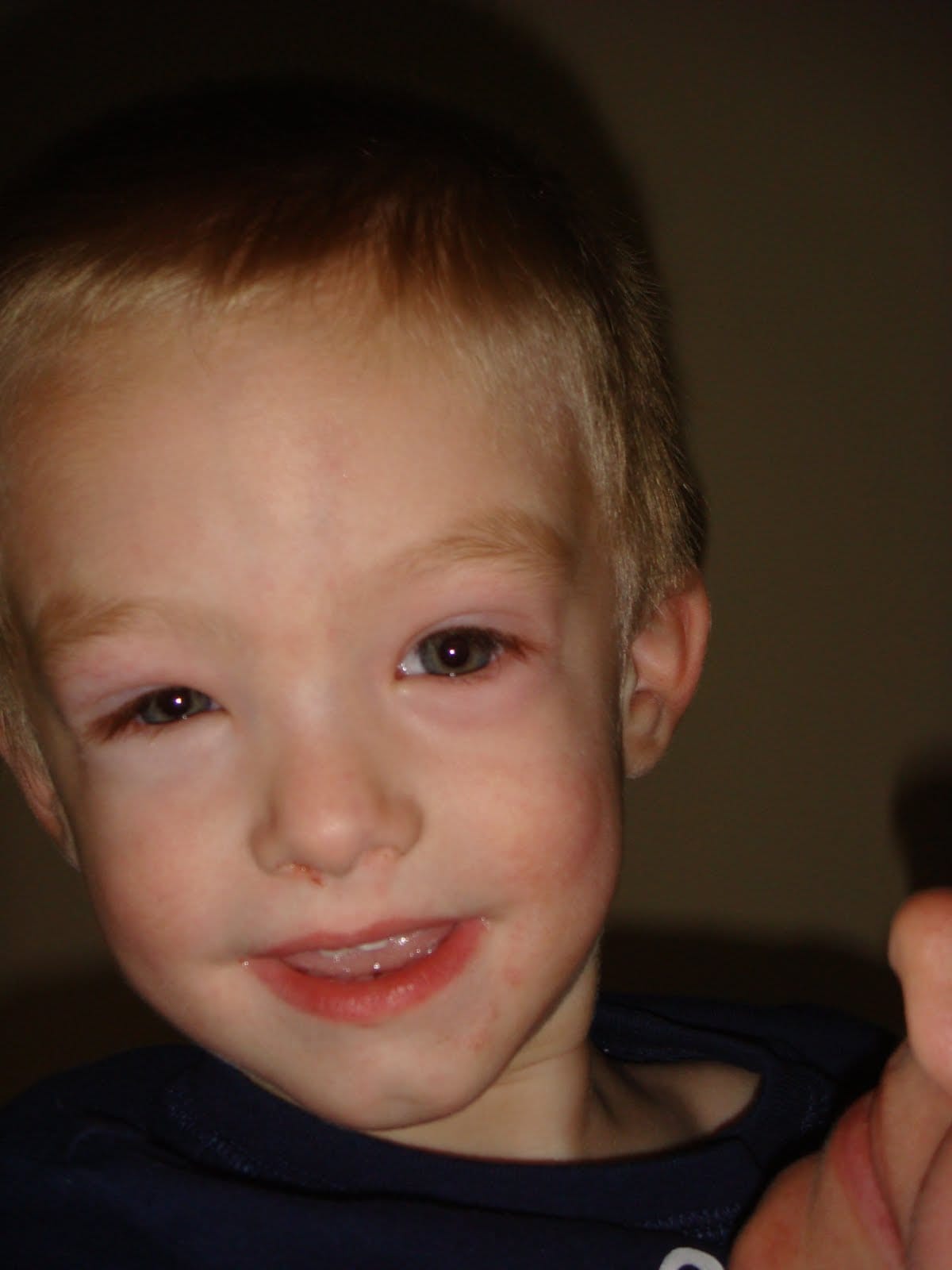 A Bad Seed: The Cashew 'Nut'