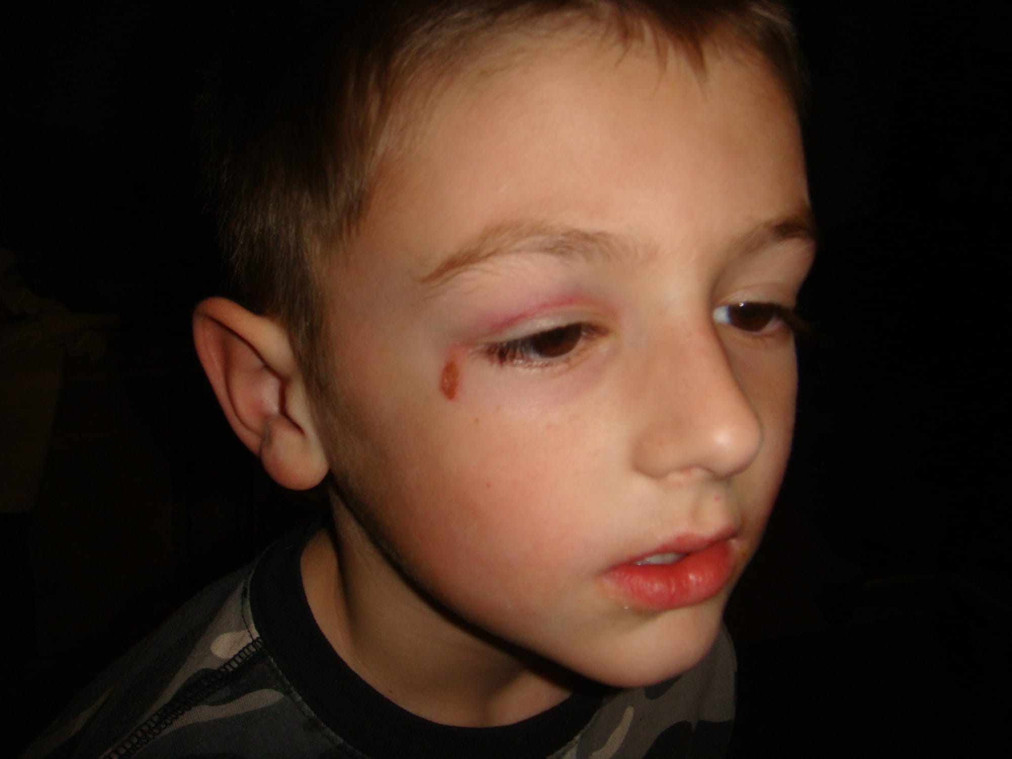 Looks like a black eye....