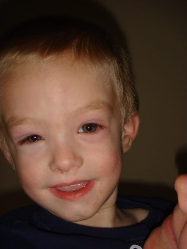 A Bad Seed: The Cashew 'Nut'