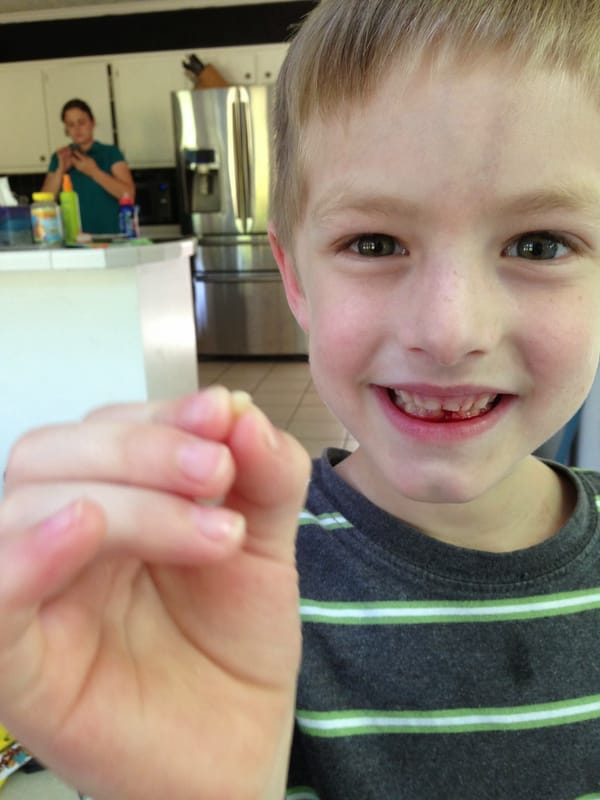 Tucker loses his first tooth